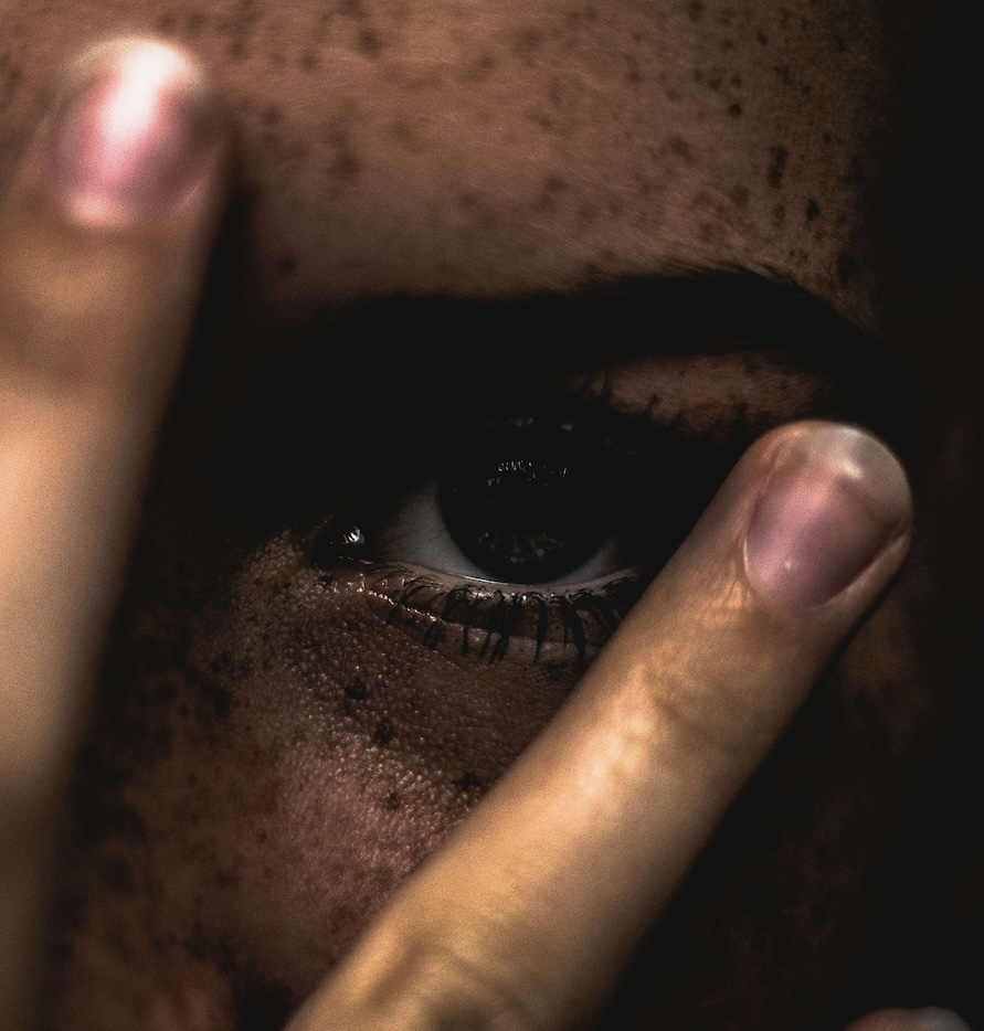 Image of a woman, with a freckled face, covering her face with her hand, showing only her eye. Discover how effective EMDR therapy in Las Vegas, NV can be when coping with your phobias.